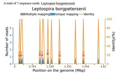 Leptospira infection complicated by demyelinating disease: A case report